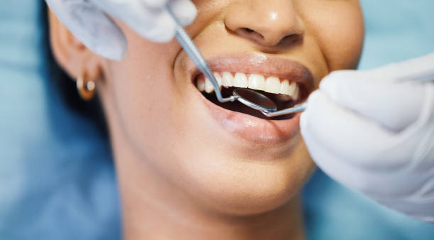 Best Chipped Tooth Repair Near Me  in Long Valley, NJ