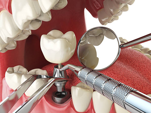 Best Knocked-Out Tooth Emergency  in Long Valley, NJ